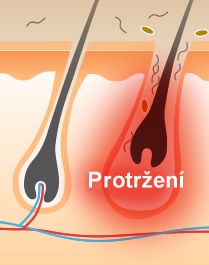  Protržení